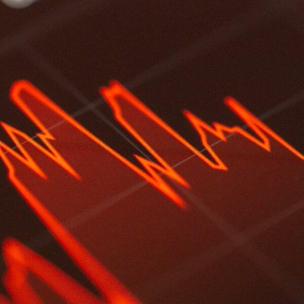 Financial charts illustrating Bitcoin options puts calls and Greeks